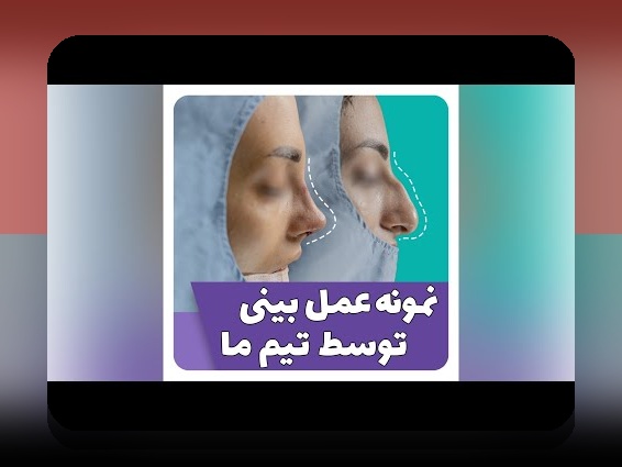 همه چیز درباره عکس قدیمی محسن یگانه قبل از عمل بینی: داستانی جذاب و پر رمز و راز